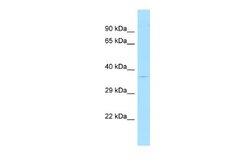 Ataxin 7-Like 3 Rabbit anti-Human, Polyclonal, Novus Biologicals 0.1ml;